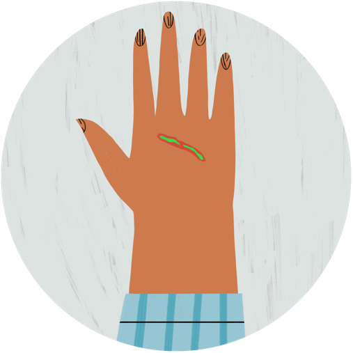 Illustration of a hand with a green line symbolizing an infection