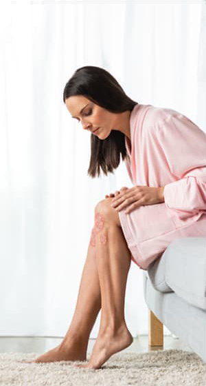 Woman looking at psoriasis on legs